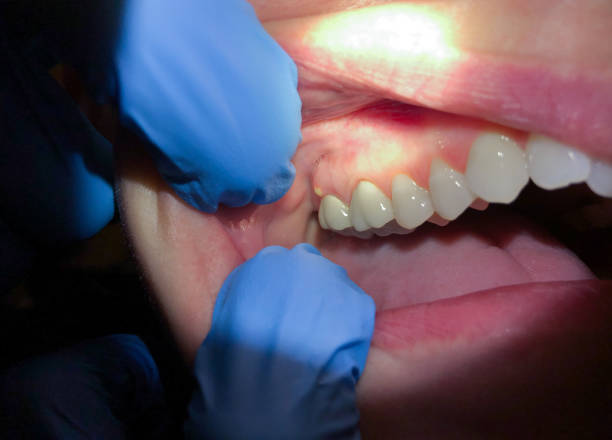 Best Urgent Dental Care for Toothache in Foster Brook, PA